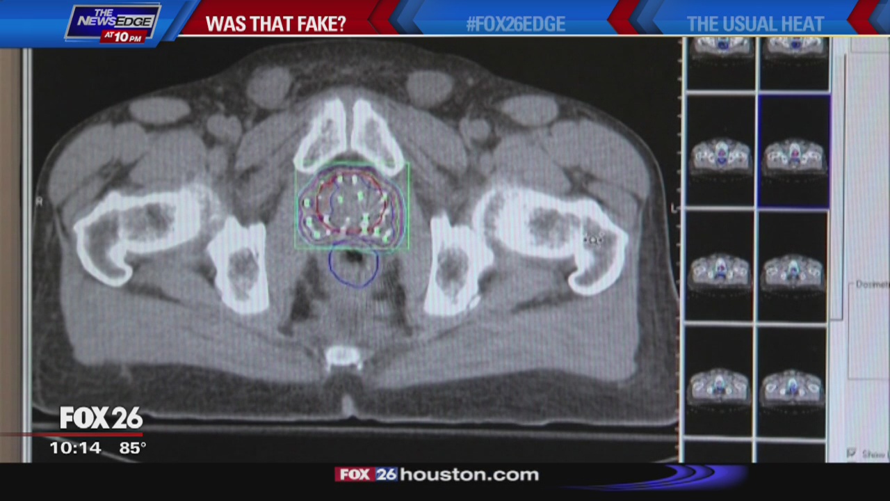 Was That Fake? - skin cancer causes phallus loss