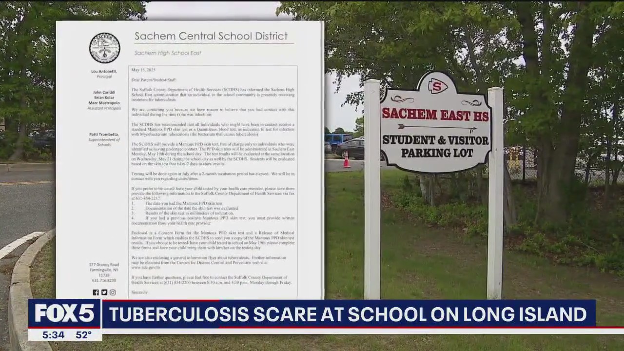 Tuberculosis scare at Long Island school