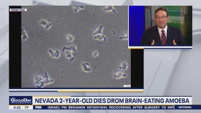 Health watch: Brain-eating amoeba is tiny but deadly