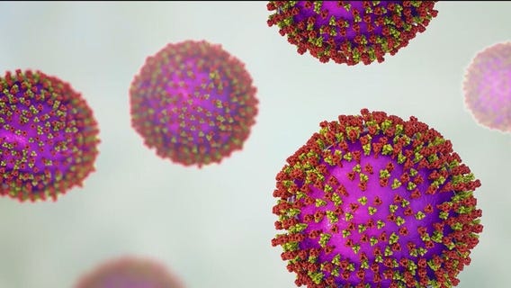 Measles surge continues: CDC reports over 160 infections across the U.S.