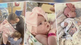 4-month-old needs double lung transplant