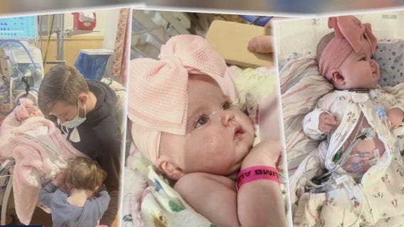 4-month-old needs double lung transplant