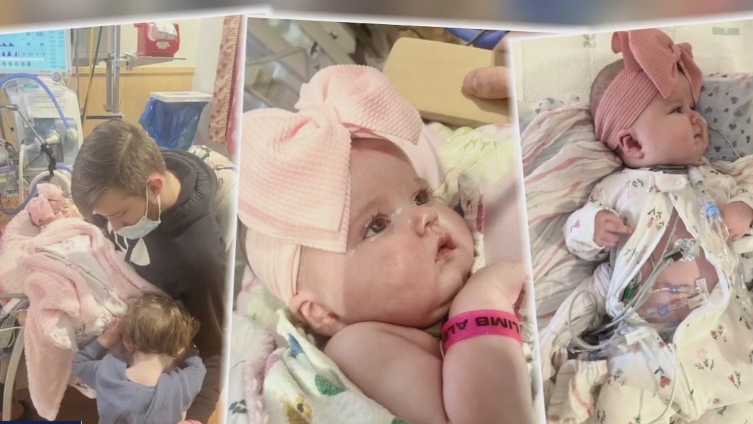 4-month-old needs double lung transplant