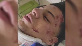 Tensions flare after viral video shows Oak Lawn cops punching teen suspect