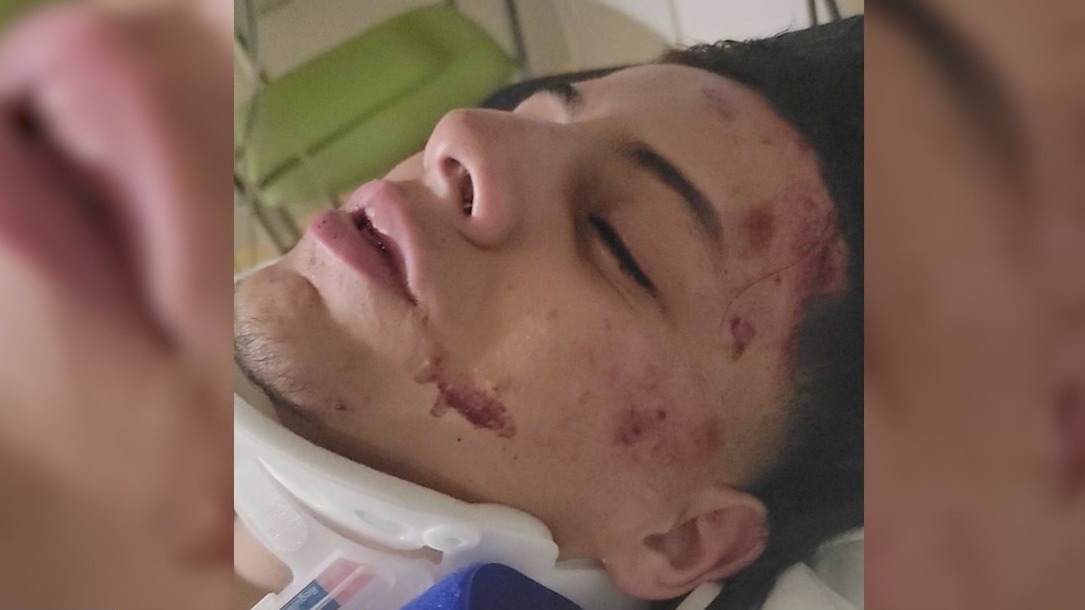 Tensions flare after viral video shows Oak Lawn cops punching teen suspect