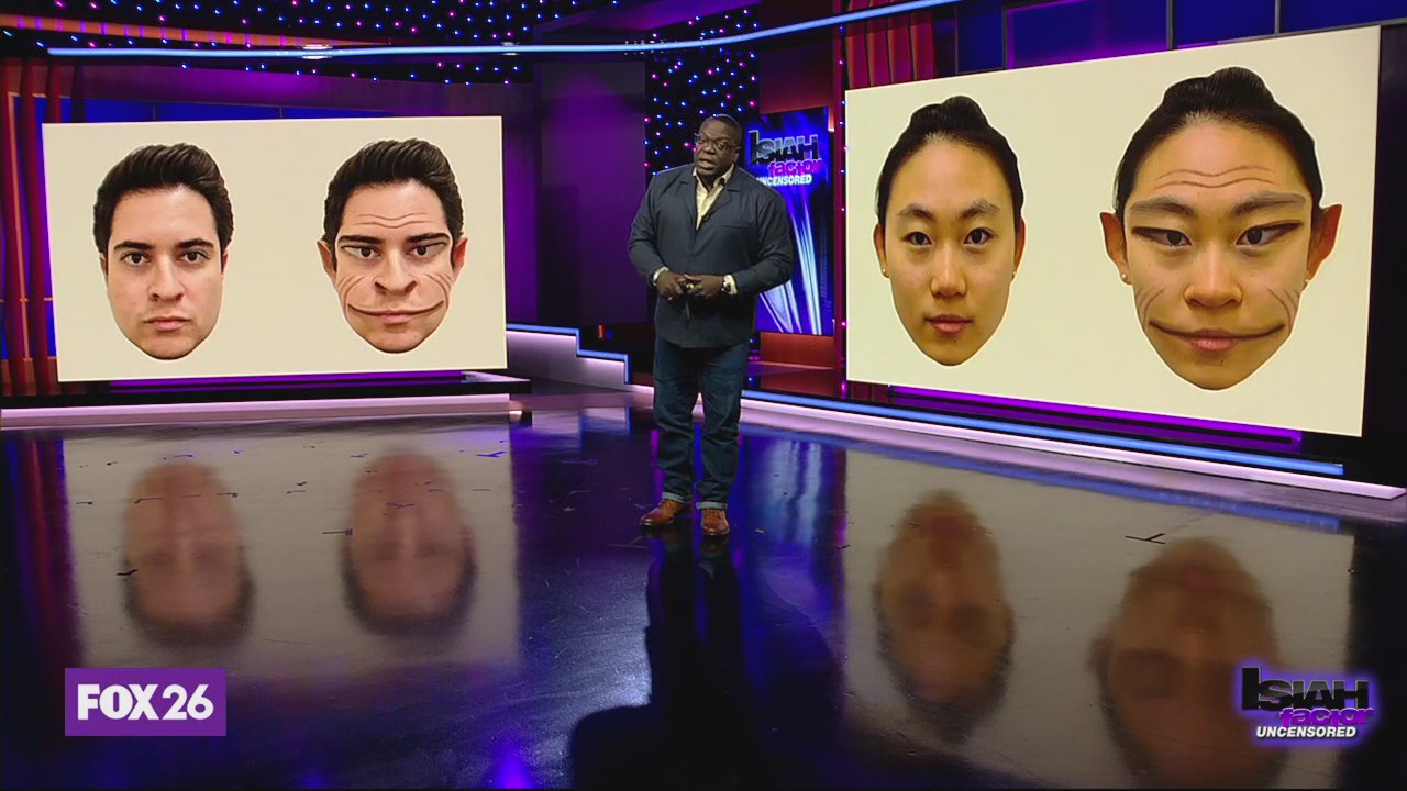 Rare 'demon face' syndrome