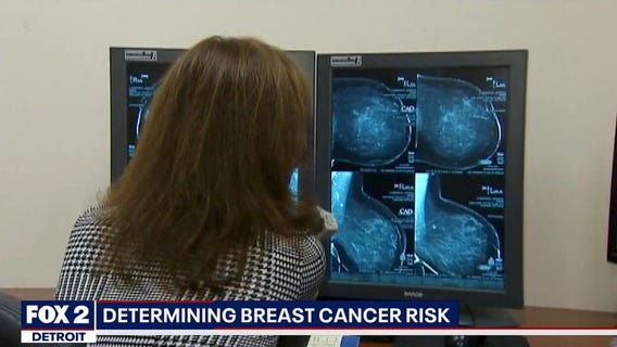 Breast Cancer Screening and Early Detection