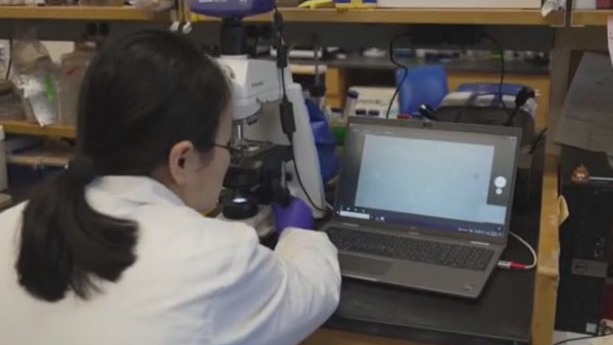 Gut microbiome tests: Experts issue warning