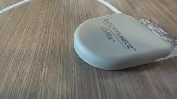 New Minnesota heart treatment procedure being used