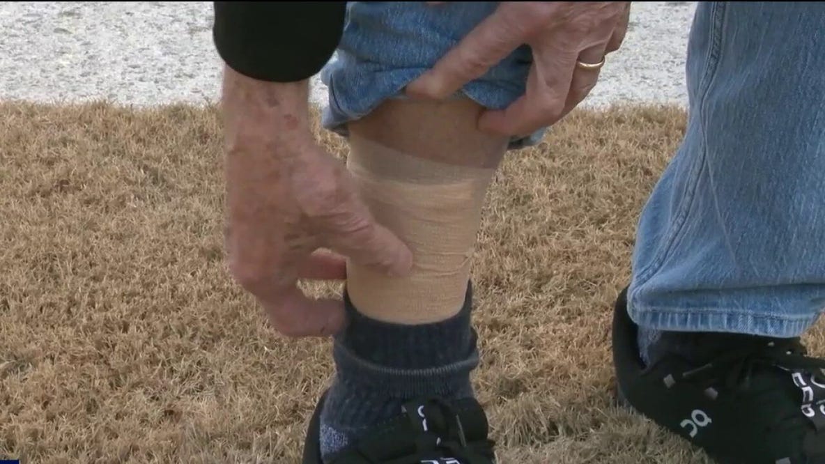 Rabid coyote bites man, pets in Buford