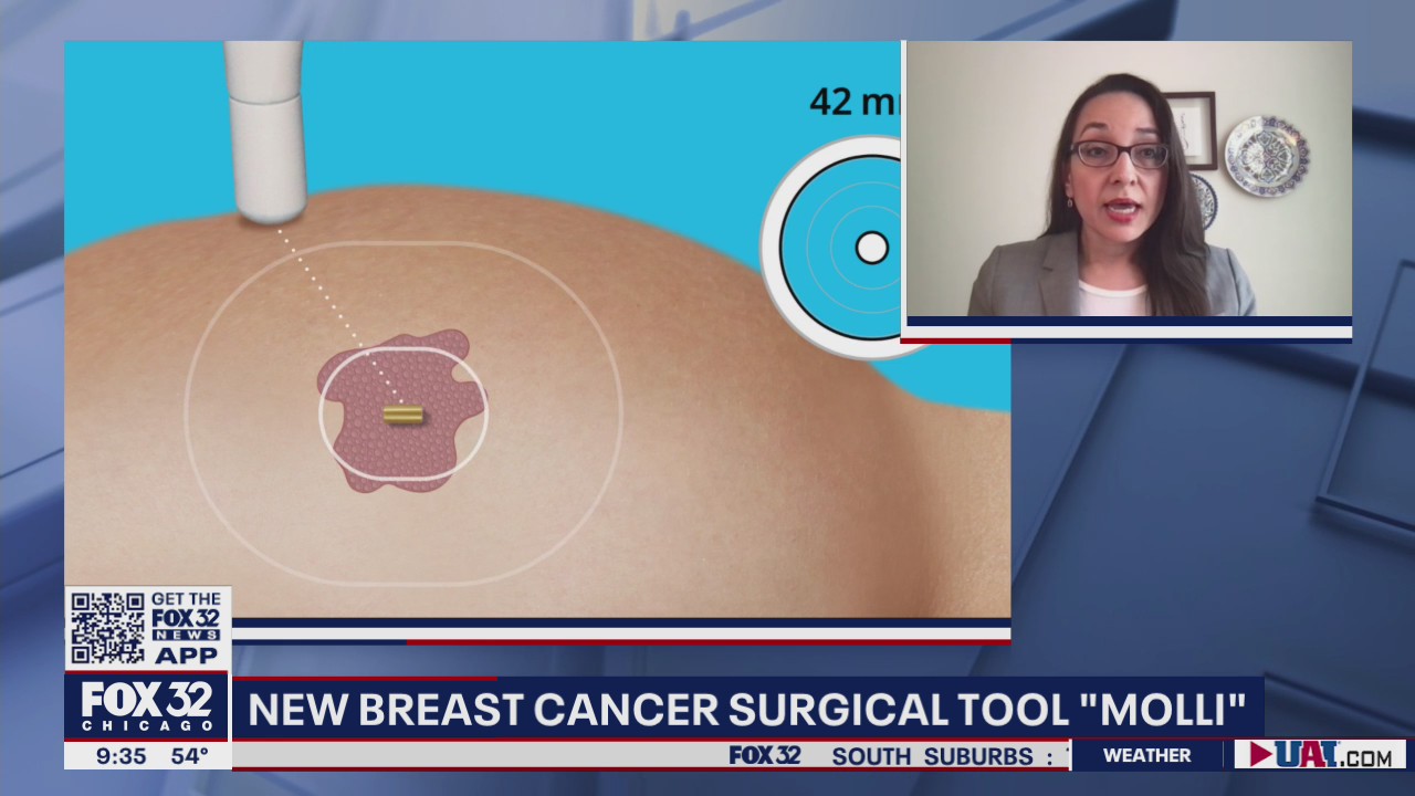 New breast cancer surgical tool showcases important development in treatment