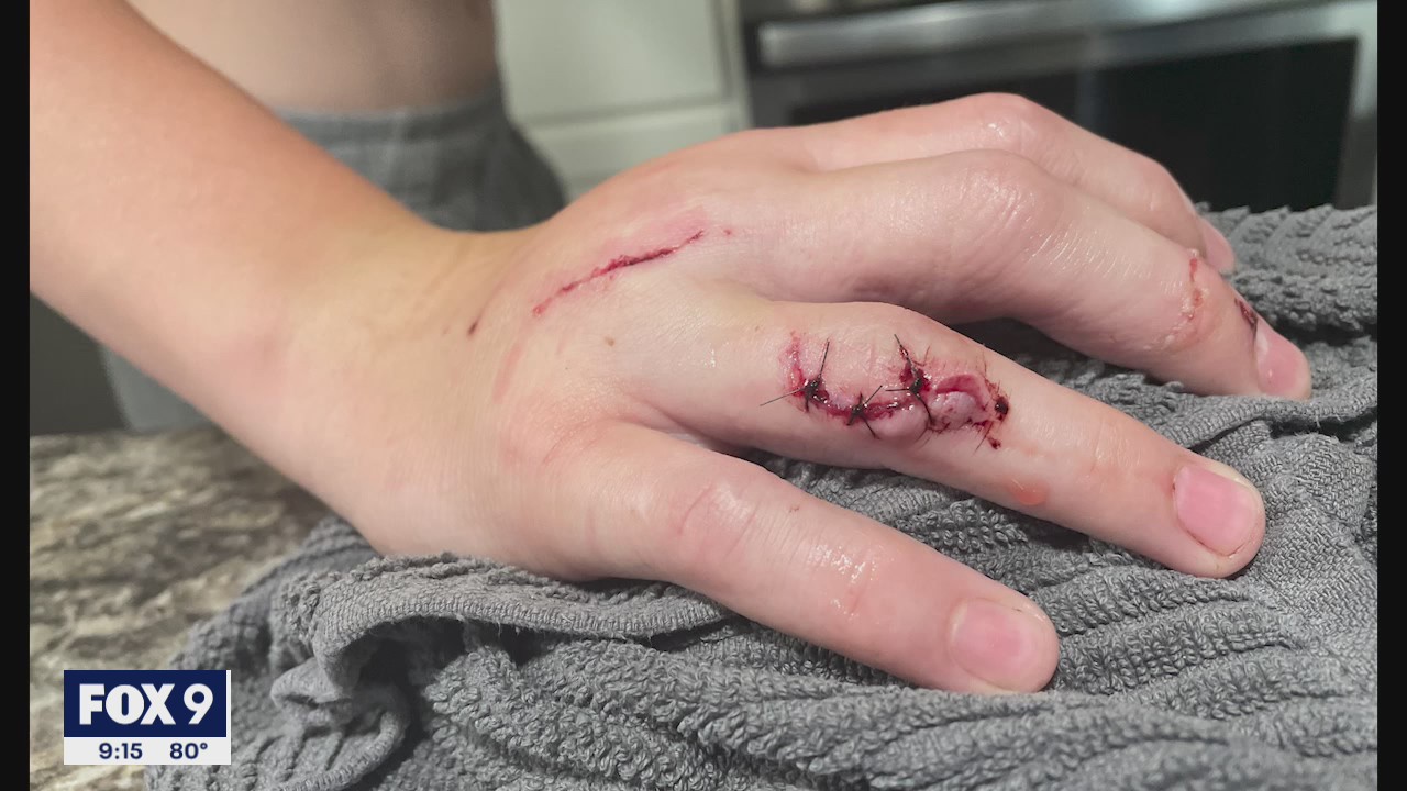 Off-duty K9 officers bites teen