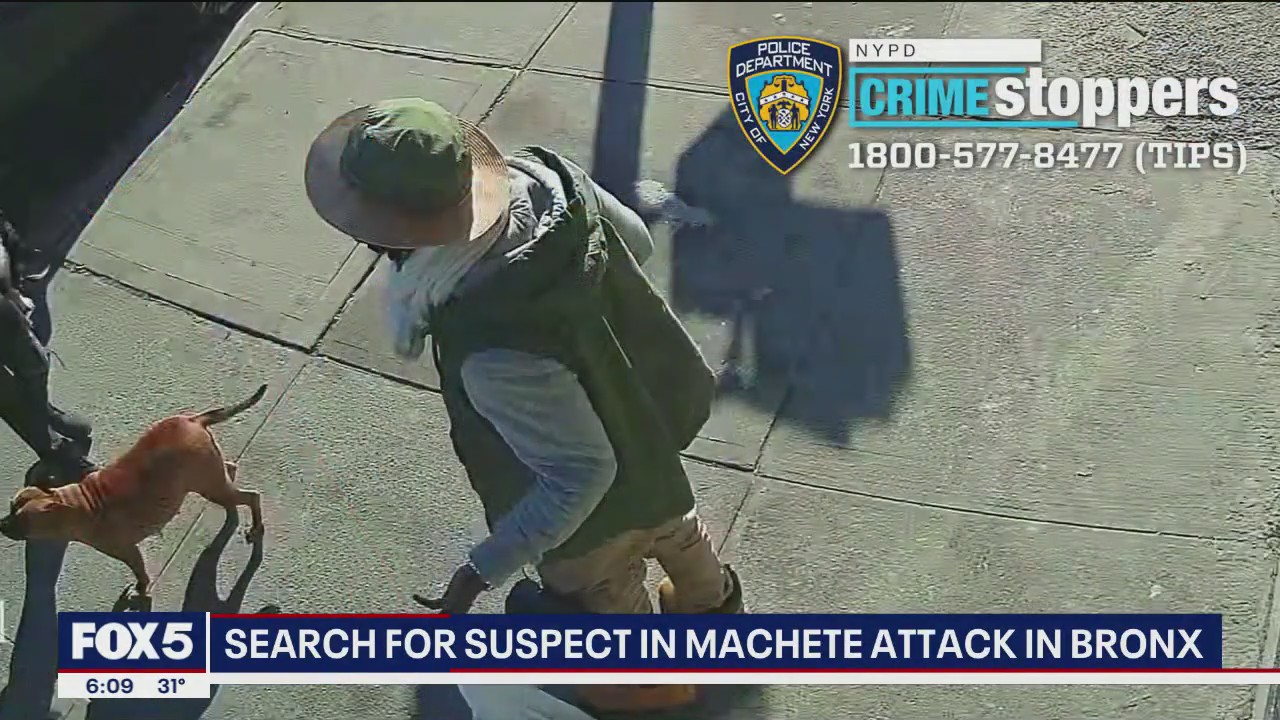 Bronx man gets hand chopped by machete-wielding man