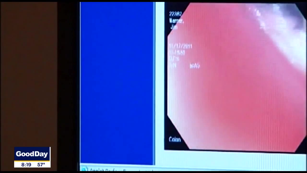 April is Esophageal Cancer Awareness Month