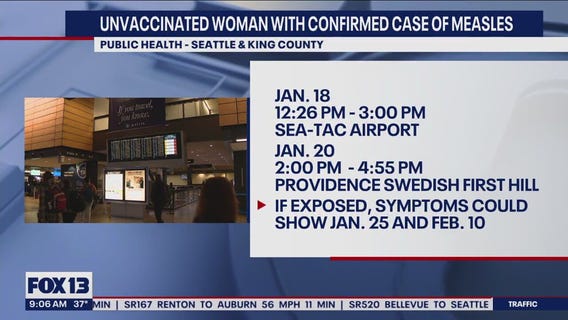 Unvaccinated woman with confirmed case of measles was at SEA Airport, local hospital