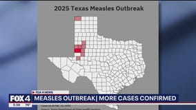 Texas Measles outbreak 2025: 124 cases identified
