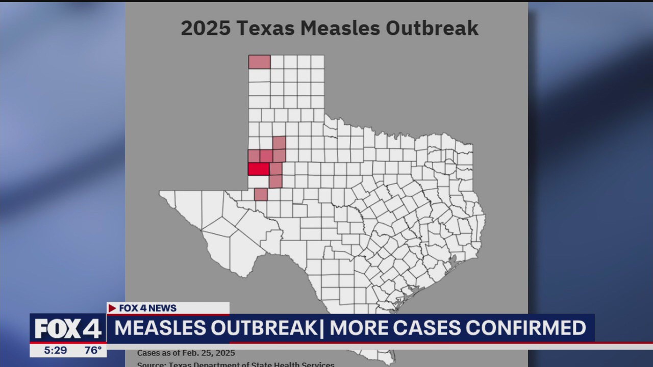 Texas Measles outbreak 2025: 124 cases identified