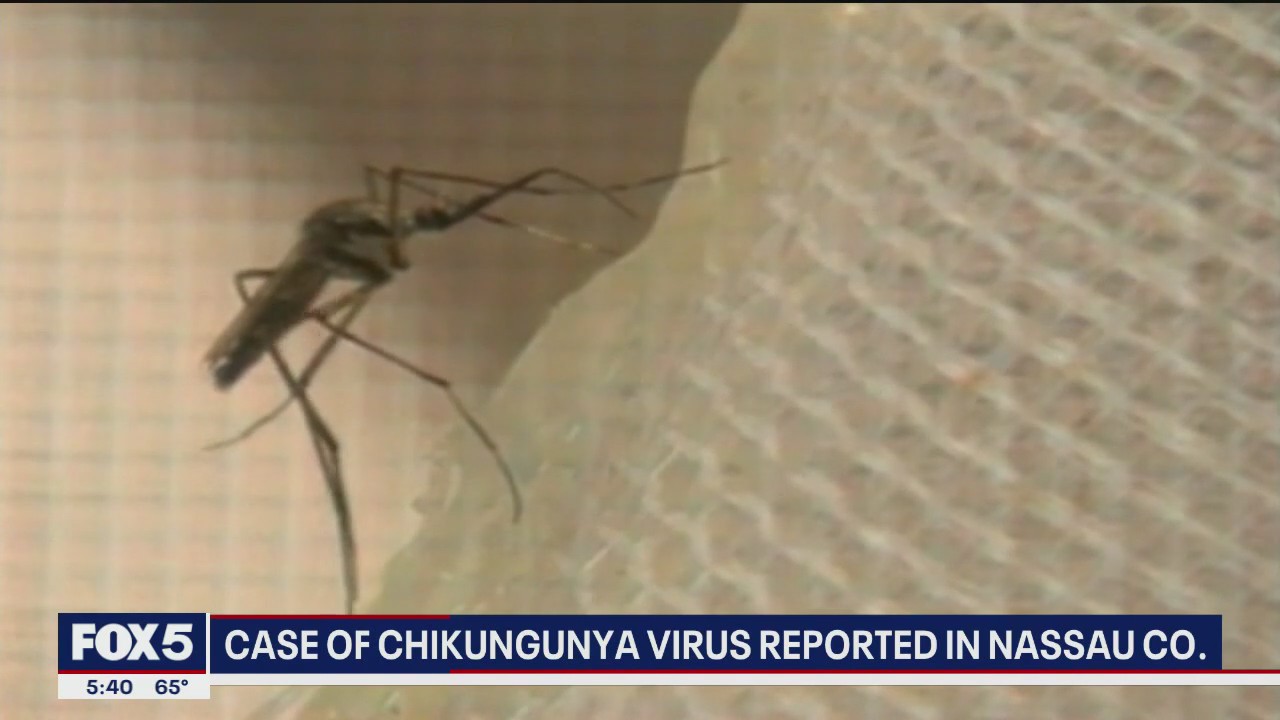 Case of chikungunya virus reported in Nassau County