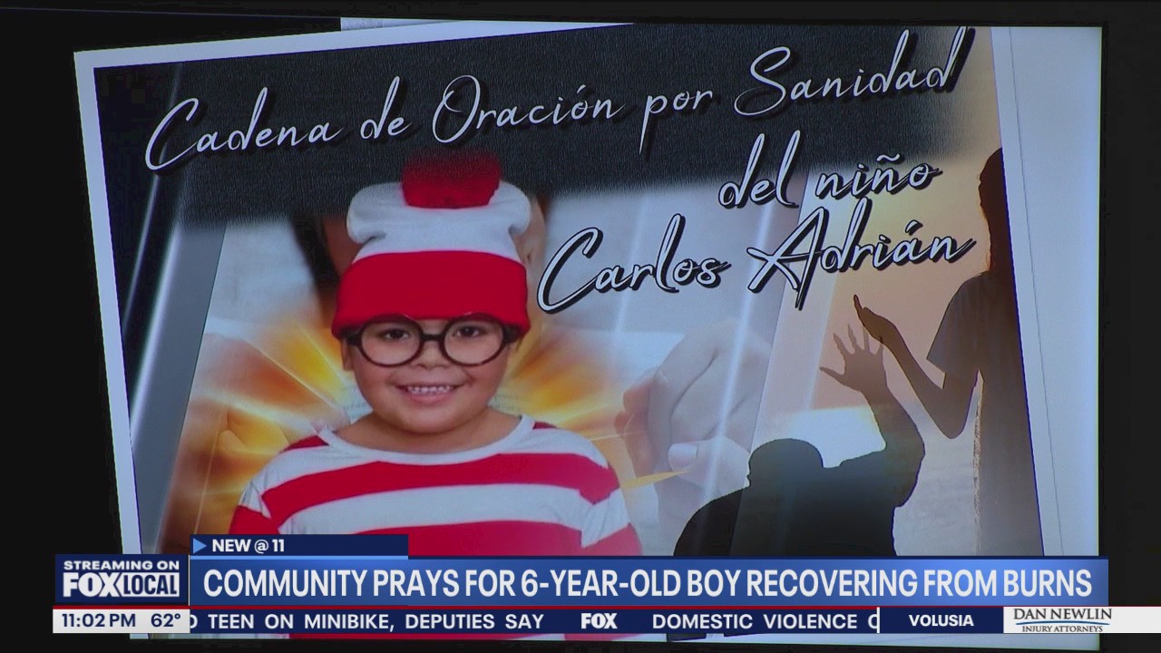 Community prays for boy recovering from severe burns
