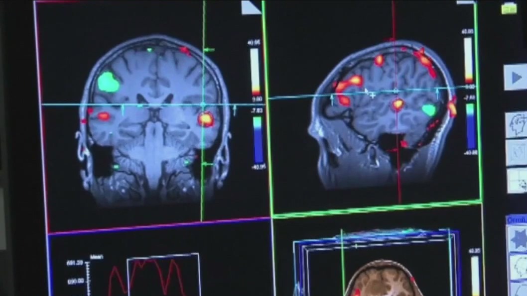 Shingles vaccine could help slow dementia according to study | ChicagoNOW