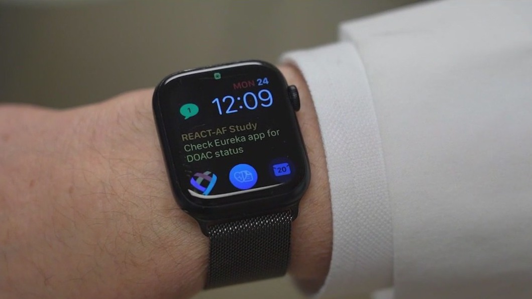 Northwestern study tests if wearables can cut AFib patients? need for blood thinners