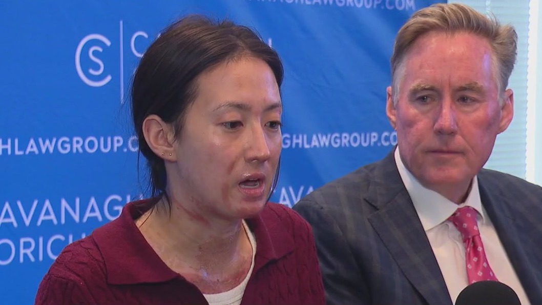 Woman describes "excruciating pain" after being burned by flames at Navy Pier restaurant