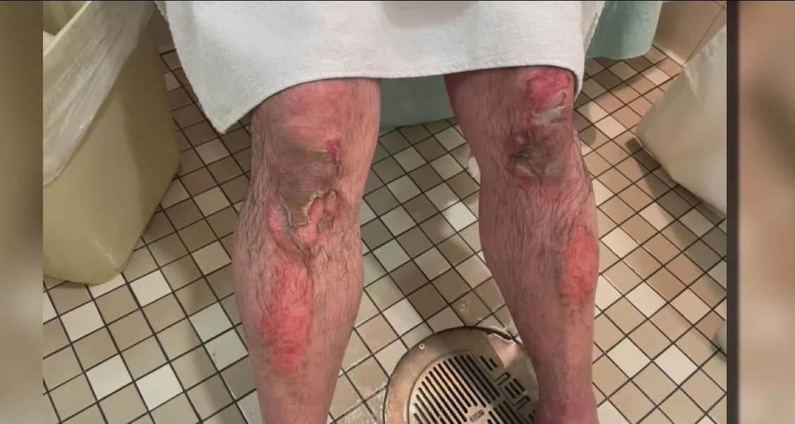 Wauwatosa house fire, family in need of help