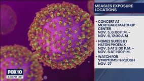 Possible measles exposure reported at 2 locations in downtown Phoenix