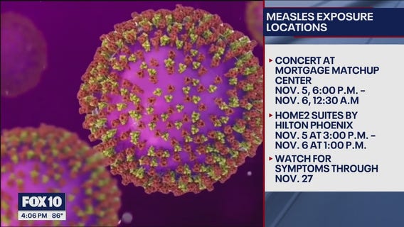 Possible measles exposure reported at 2 locations in downtown Phoenix