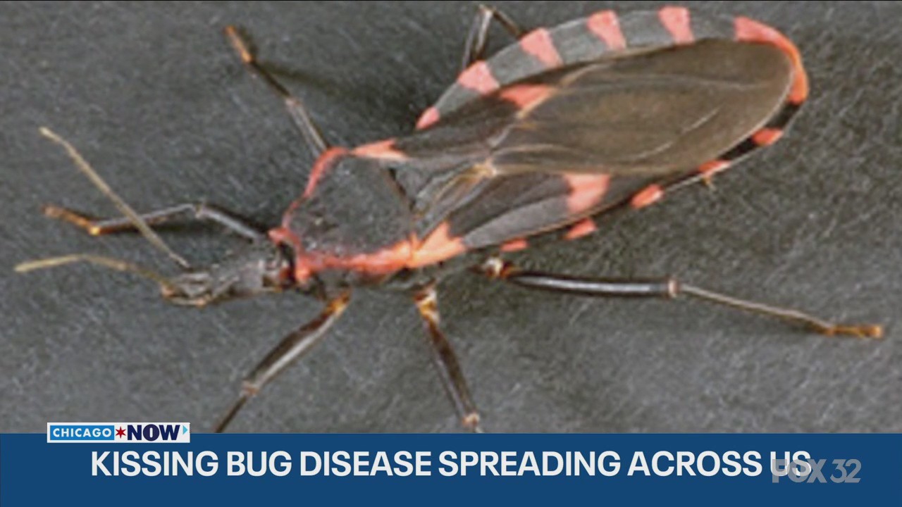 Chagas Disease and the ?Kissing Bug?: What you need to know | ChicagoNOW
