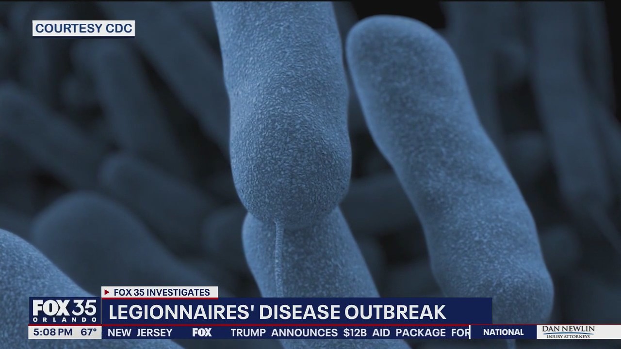 Orange County health officials investigate Legionnaires’ cases