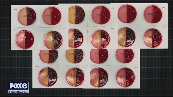 How much bacteria is on your mask? Contact 6 gets answers