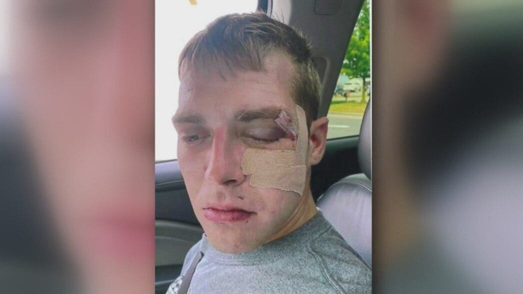 Man awarded $4M in excessive force lawsuit