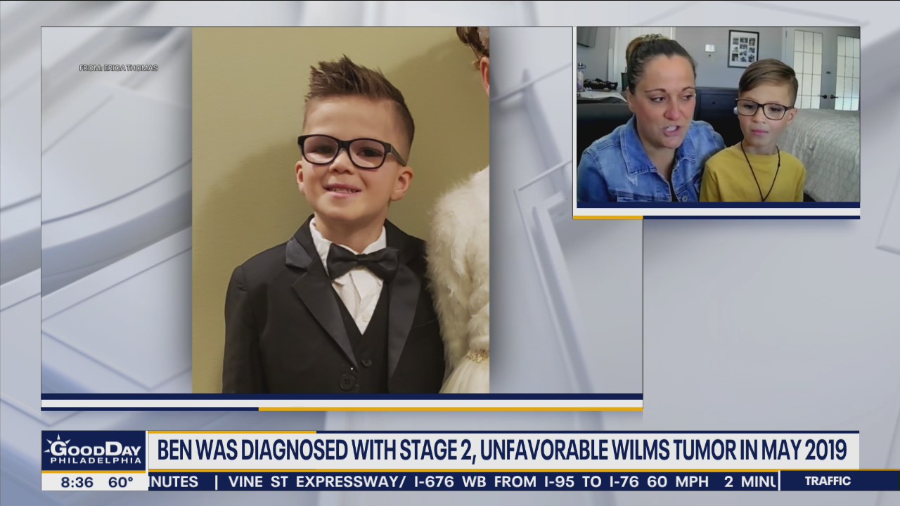 Young cancer surviver helps doctors speak to young patients