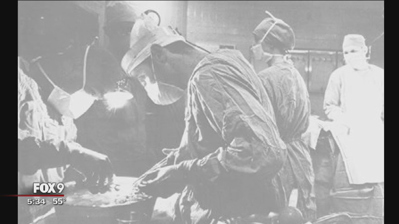 U of M celebrates 50 yrs of pancreatic transplants