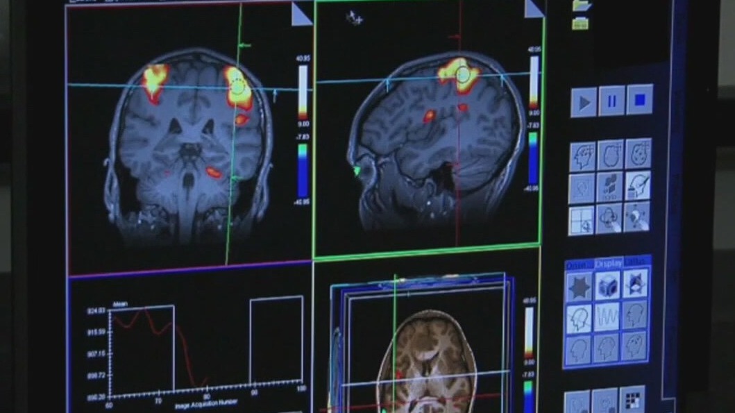 Noise canceling headphones linked to brain damage