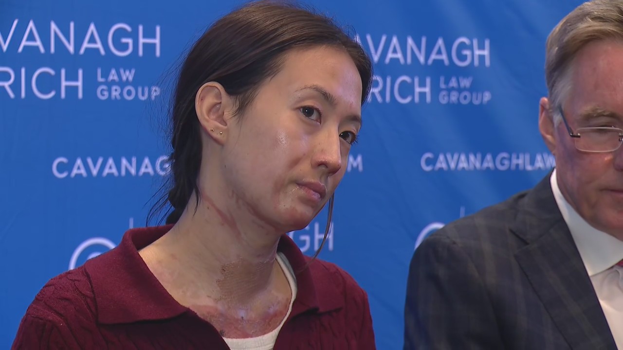 Woman describes moment she caught fire at Navy Pier restaurant