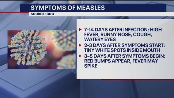 Health official gives measles case details in Oakland County