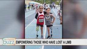 Wiggle Your Toes working to empower those who have lost a limb