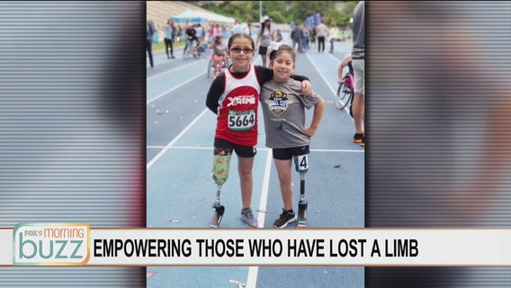 Wiggle Your Toes working to empower those who have lost a limb