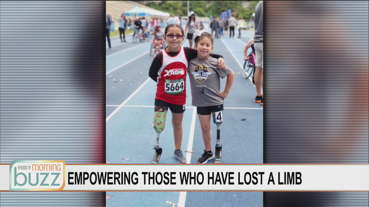 Wiggle Your Toes working to empower those who have lost a limb