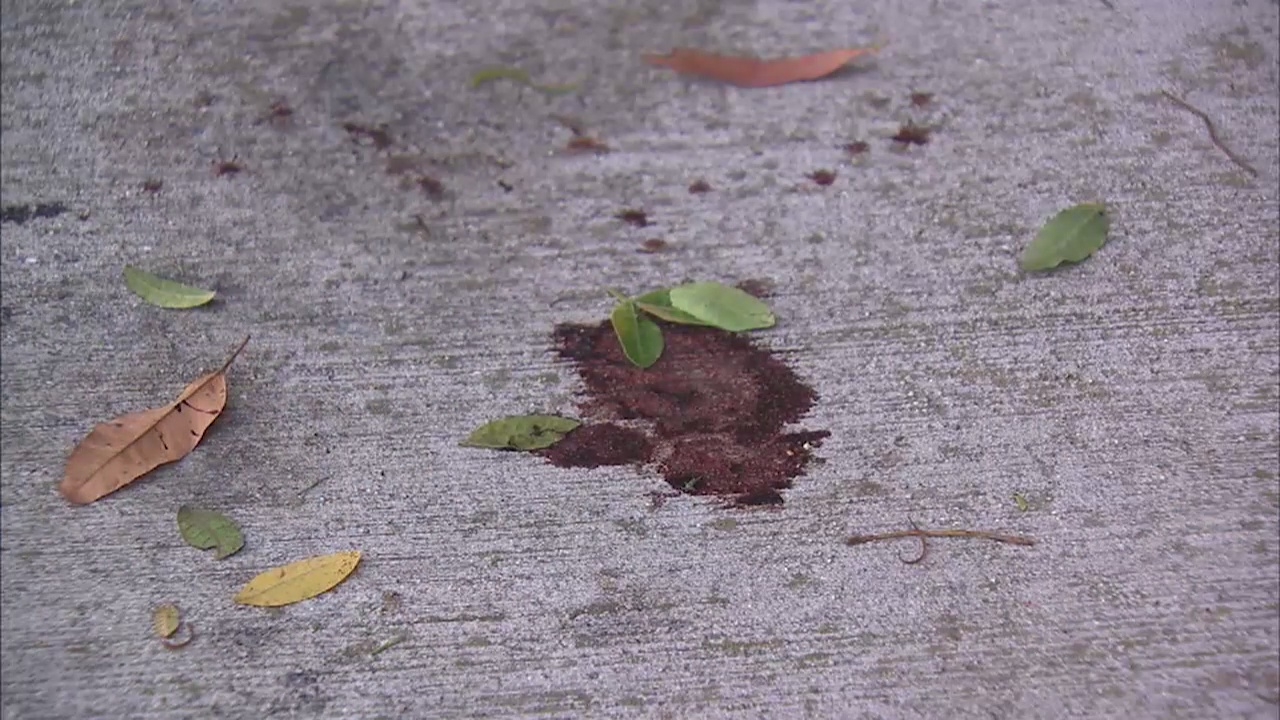 Deputy DA attacked while jogging in Newport Beach