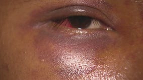 Street vendor in San Bernardino brutally beaten