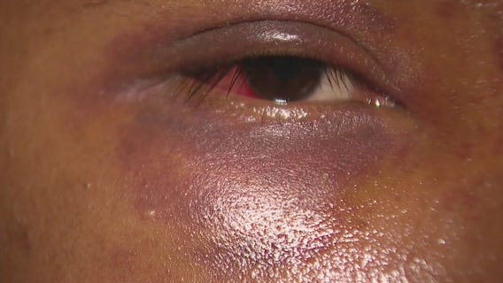 Street vendor in San Bernardino brutally beaten