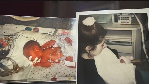 From NICU patient to nurse