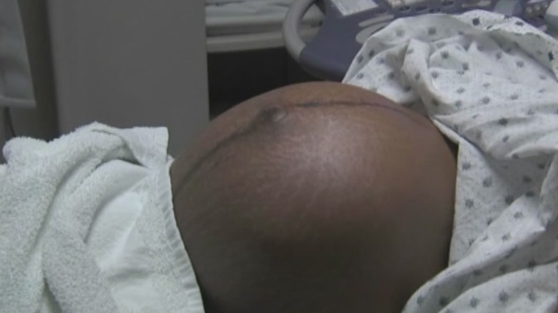 Professional male doula shares his experience