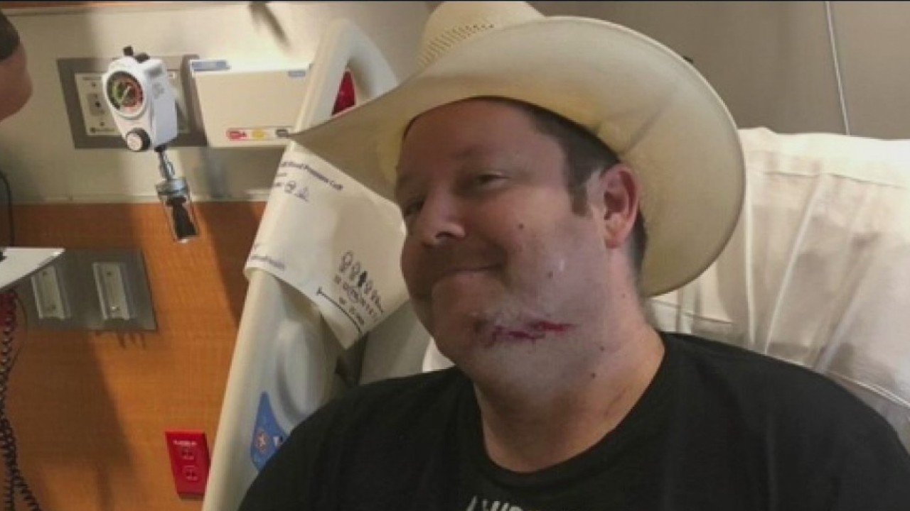 Fort Bend County deputy speaks out after being shot