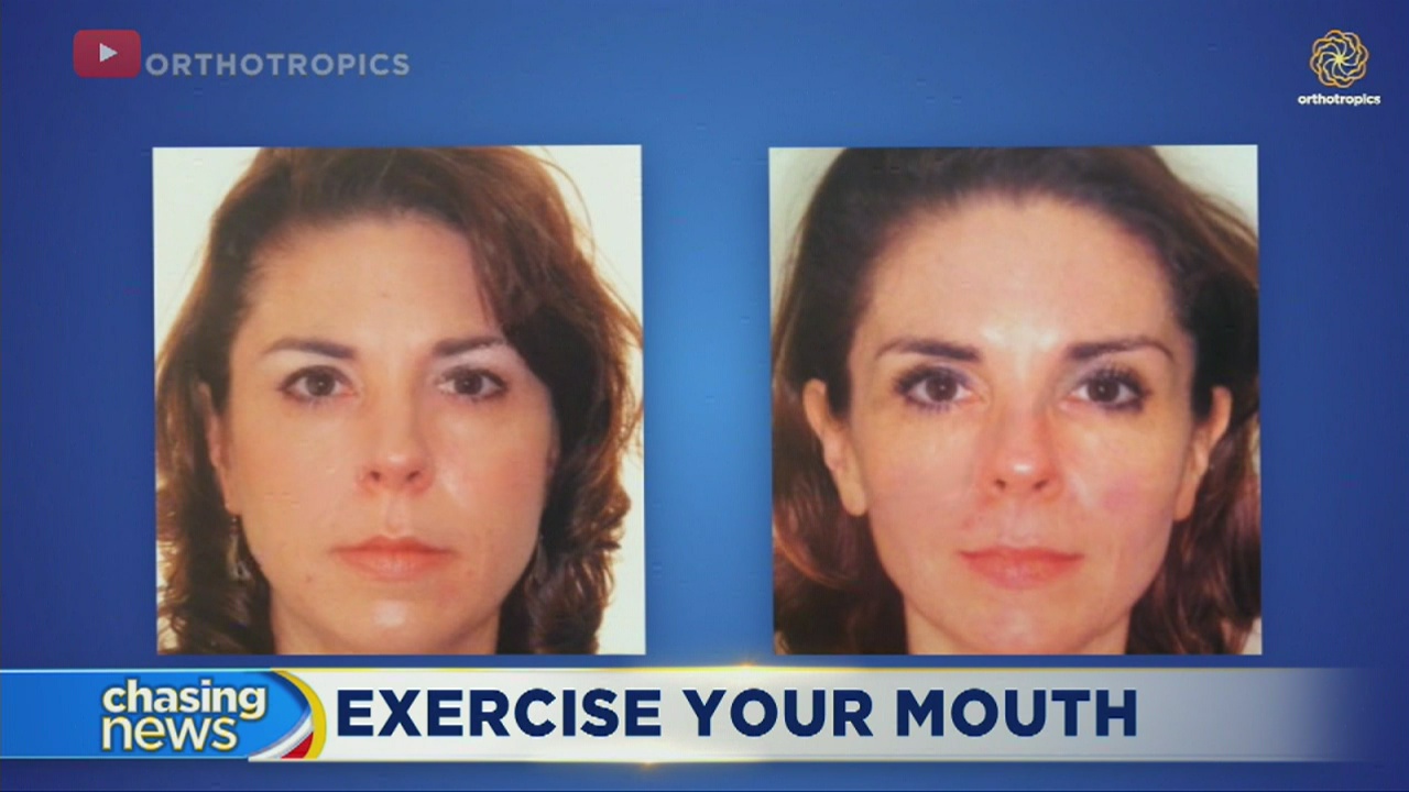 Mewing touted for ability to improve health, looks