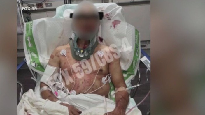 Former Jets' QB Mark Sanchez now facing felony battery charges