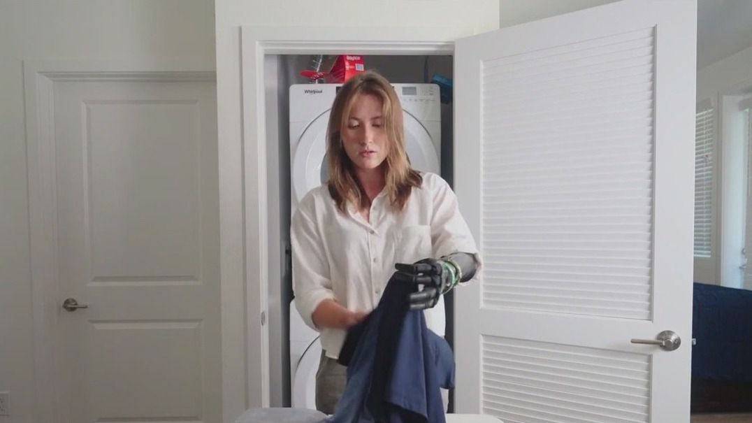 Bionic prosthetics powered by AI changing lives